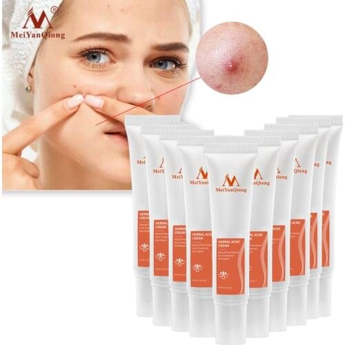 10PCS Skin Care Acne Cleaning Cream Remove Repair Comedone Pimple Acne Quickly Face Acne Cream Remover Anti Acne Treatment