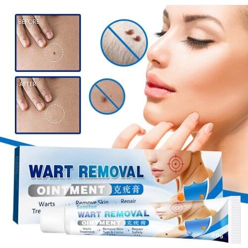Warts Remover Antibacterial Ointment Wart Treatment Cream Skin Tag Remover Herbal Extract Corn Plaster Warts Ointment