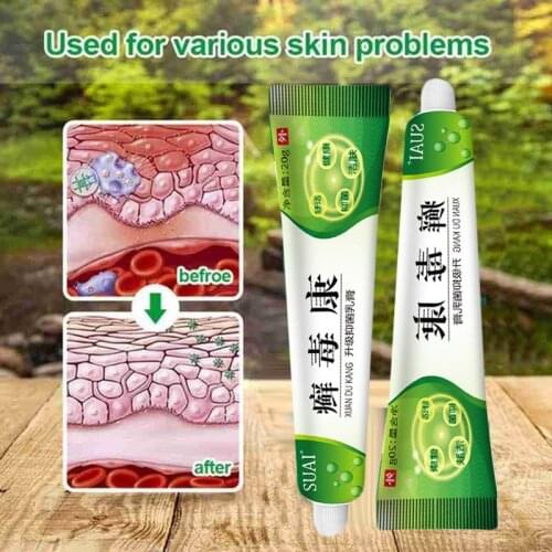 1PC Eczema Cream Anti-itching Psoriasis Antibacterial Dermatitis Pruritus Eczematoid Chinese Herbal Medical Ointment 20g