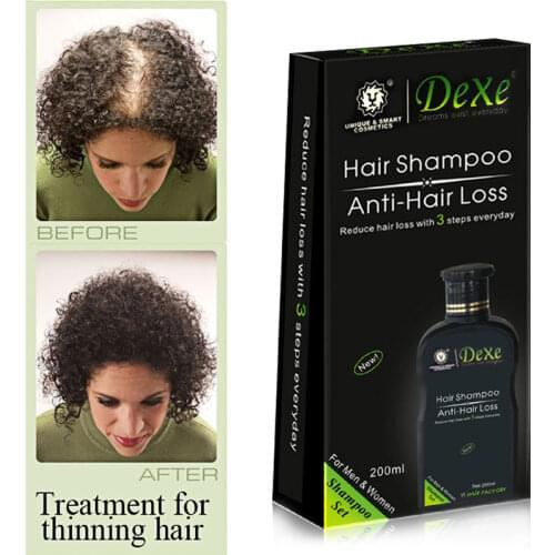 Dexe Professional hair growth Shampoo Anti-hair Loss Chinese Herbal Hair Growth Product Prevent Hair Treatment for Men & Women