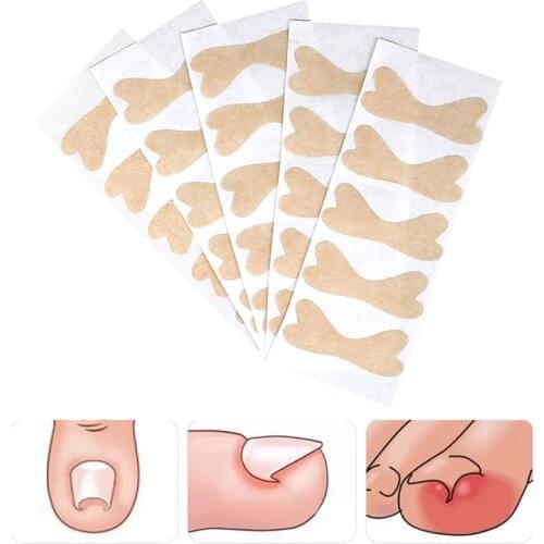 Ingrown Toenail Corrector Sticker Paronychia Treatment Recover Corrector Toe Inlay Nail Corrector Nail Patch Correction Sticker