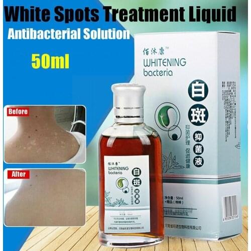 50ml Skin Treatment White Spot Disease Liquid Pigment Promoting Treatment Liniment Leukoplakia Vitiligo Melanin Skin Diseas Z7A2
