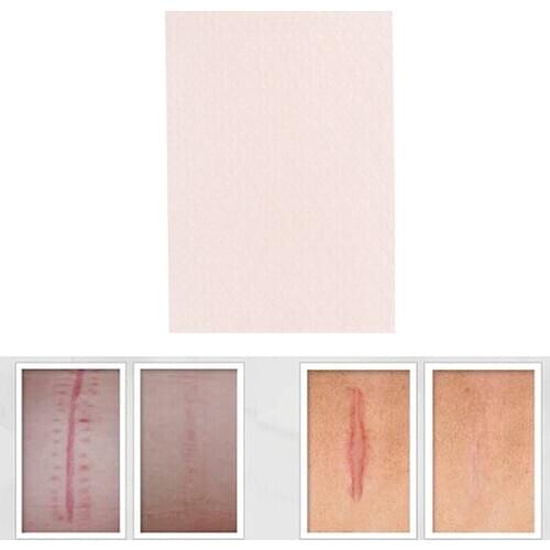 Silicone Gel Scar Sheet Removal Patch Reusable Acne Gel Scar Therapy Sheet Skin Repair Visible Scar Treatment 5cmx3.5cm
