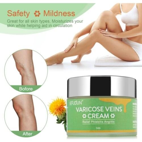 50g Natural Varicose Veins Cream Serum For Legs Care Vasculitis Phlebitis Spider Cream Varicosity Angiitis Removal Cream TSLM1