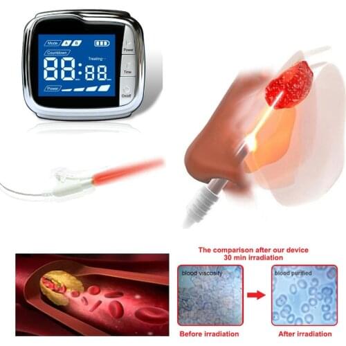 High Blood Pressure Diabetes Cholesterol Rhinitis Treatment Cerebral Thrombosis Medical Device Laser Therapy Watch