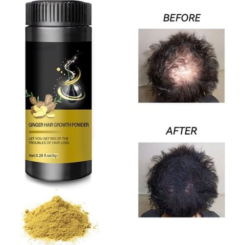Ginger Hair Growth Powder Nourish Hair Regrow Powder Reduce Hair Loss Fast Grow Anti Hair Loss Hair Care Product 8g