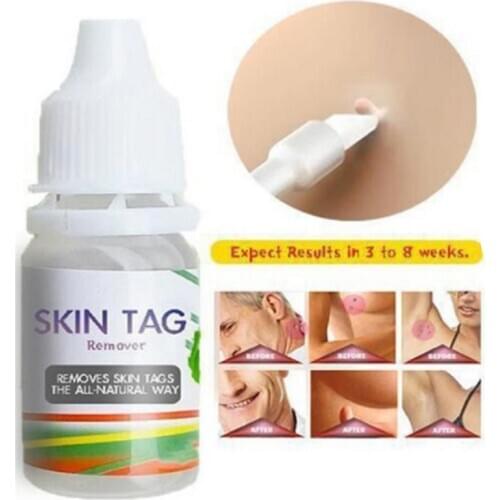 Genital Wart Treatment Papillomas Removal of Warts Liquid From Skin Tags 12hours Removing Against Moles Anti Verruca Remedy