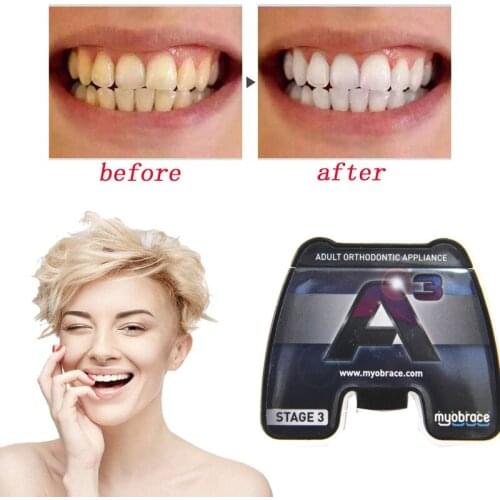 Appliance Alignment Trainer / Denal Teeth Alignment Appliance Alignment Trainer Dental Orthodontic Appliance A3