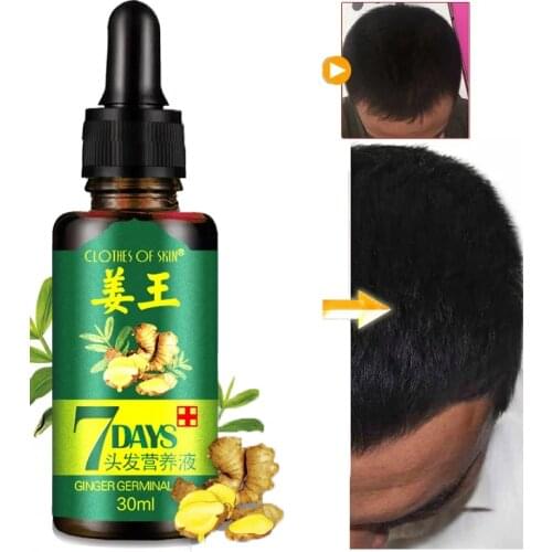 Natural Repair Fast Hair Growth Fluid Hair Loss Treatment Healthy Hair Growth Liquid Biotin Essence