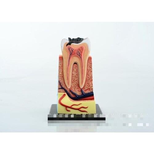 Puzzle Master Builder of human tooth model can be assembled medical model, dental model