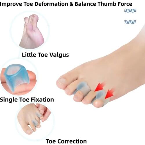 10pcs=5pairs Silicone Orthopedic Straightener Gel Toe Separator Corrector Hallux Valgus Fingers Bunions Protector Foot Pedicure