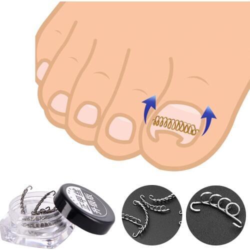 Professional 12pcs/set Nail Art Ingrown Toenails Correction Wire Recover Care Paronychia File Patch Corrector Foot Pedicure Tool