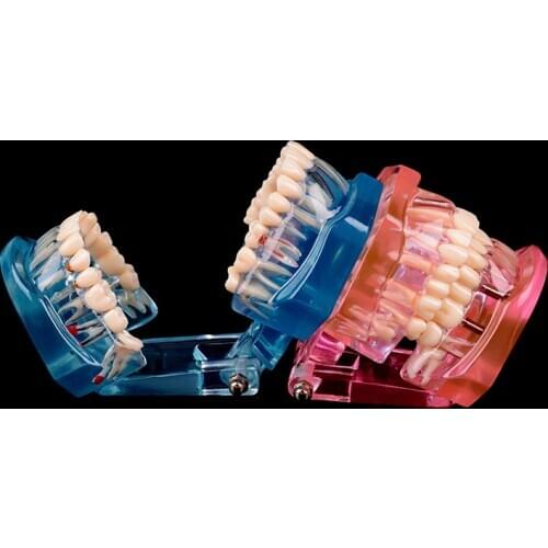 JETTING Products For Teeth Whitening