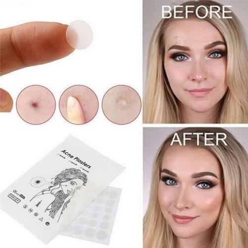 36pcs Remover Pimple Master Patch Acne Treatment Protects Invisible Acne Patch Face Care Cosmetics Face Skin Care Tools