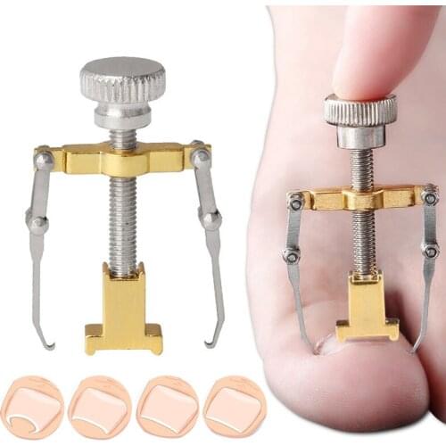 Correction Tool Ingrown Toenail Corrector Pedicure Toenail Fixer Foot Nail Care Orthotic Stainless Steel Treatment Onyxis Bunion