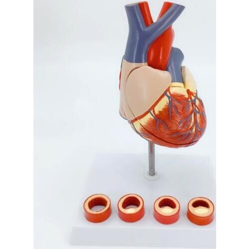 Heart vascular anatomical model Cardiac Teaching Medicine Heart with thrombus Model