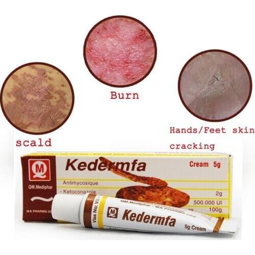 Hot Sale 5g Vietnam Kedermfa Snake Oil Hand Skin Face Care Cream For Burn Scald Skin Cracking Eczema Skin Repair Cream Dropship