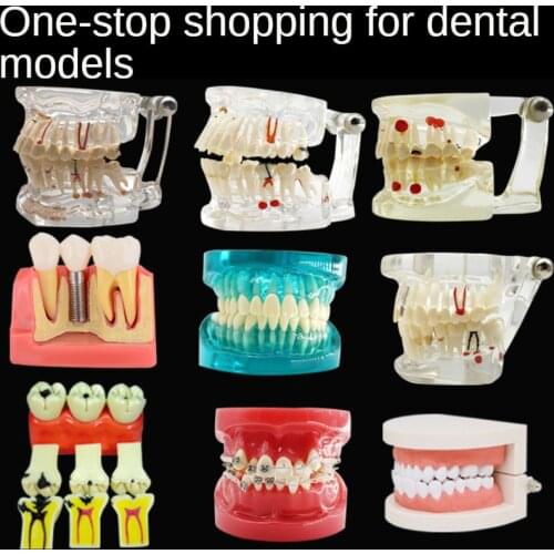 Dental teaching dental molded teeth full mouth teeth model standard model dentist oral model adults