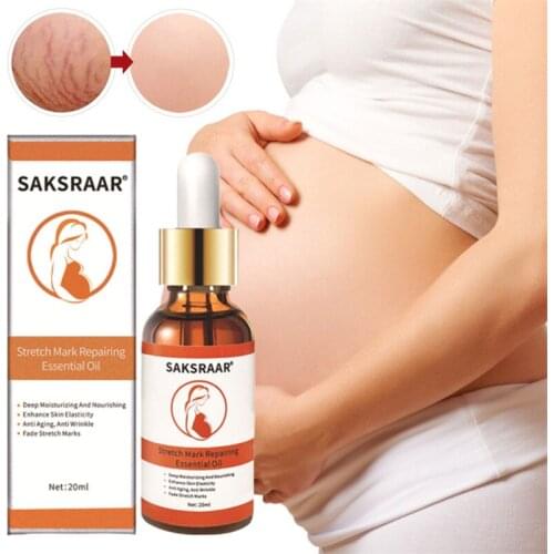 Appti Stretch Mark Oils