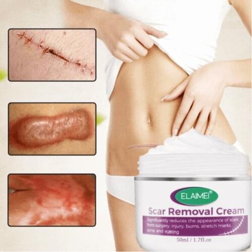Skin Rebound Scarless Cream Scar Removal Cream Face Cream For Face Acne Scar Stretch Marks Skin Repair Face Cream