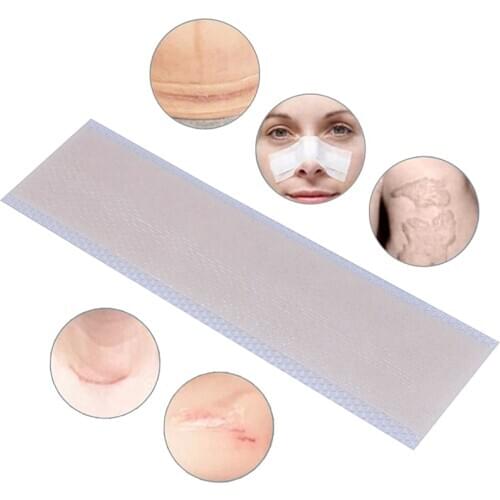 Silicone Scar Removal Patch Remove Trauma Burn Scar Sheet Skin Repair Scar Removal Therapy Patch for Acne Scar Treatment