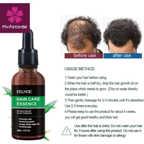 EELHOE 10/20/30/50ml Powerful Hair Loss Hair Treatment Ginger Hair Care Growth Essence Oil Hair Oil Hair Care TSLM2