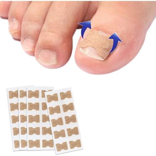 50pcs Stickers Ingrown Toenail Paronychia Treatment Toe Nail Repair Nail Correction Stickers