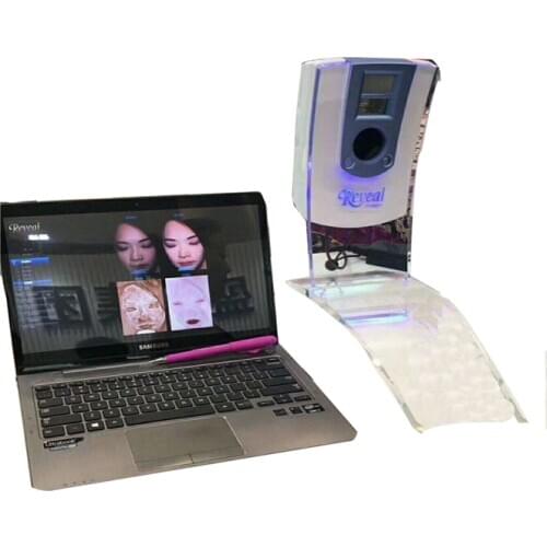 2019 new product portable uv light facial skin analysis machine/skin scope and moisture analyzer machine