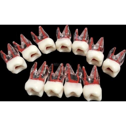 50pcs Resin Dental Tooth Root Canal Model Practice Pulp Dentistry Lab Model For Student Study Practice