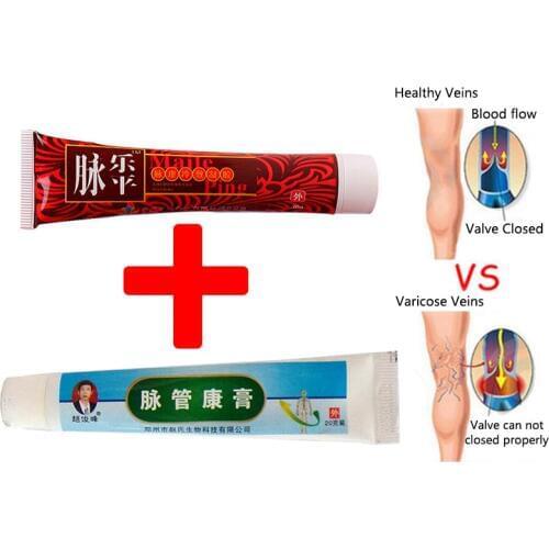Vasculitis Treatment Cream Varicose Veins Phlebitis Spider Veins Pain Angiitis Remedy Removal Herbal Balm