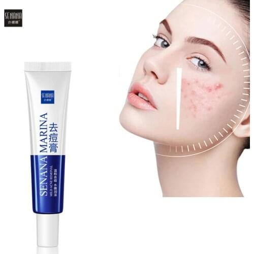 Mild Acne Treatment Cream Aloe Vera Anti-acne Gel Fades Spots Brighten Repair Oil Control Moisturizing Shrink Pores Face Care