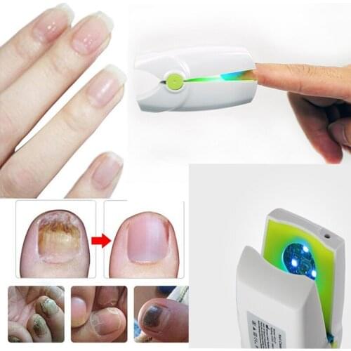 Portable Nail Laser Fungus Cold Laser Nail Fungal Infection Grey Color Toenail Laser Device Nail Mushroom Treatment