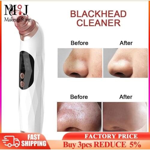 Vacuum Suction Face Blackhead Instrument Hot Compress Electric Deep Nose T Zone Pore Pimple Cleaner With Base