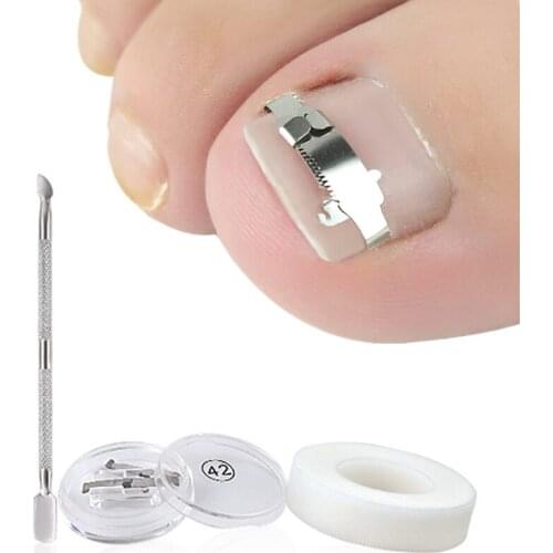 3Pcs/Set Ingrown Toenail Recover Correction Patch Pedicure Toenail Fixer Foot Care Tool Paronychia File Patch Corrector Tool