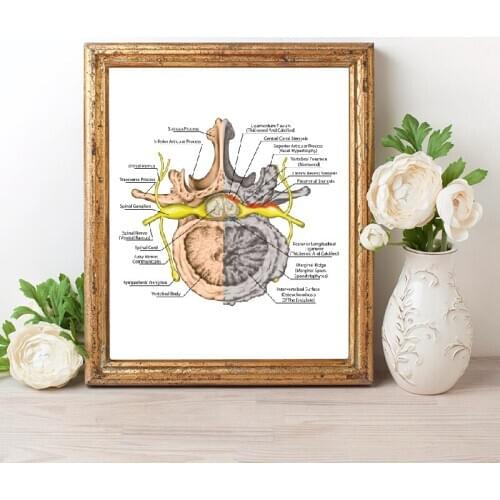 Human Nervous System Prints Osteoarthritis Poster Medicine Educational Chart Orthopedics Retro poster kraft paper