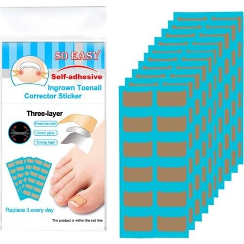 120Pcs/Set Ingrown Toenail Tool Ingrown Toenail Correction Stickers Professional Pedicure Tools for Repairing Paronychia