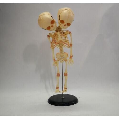 Fetal fetus Skeleton teaching educational Model Double Head Baby Skull Skeleton Anatomy model