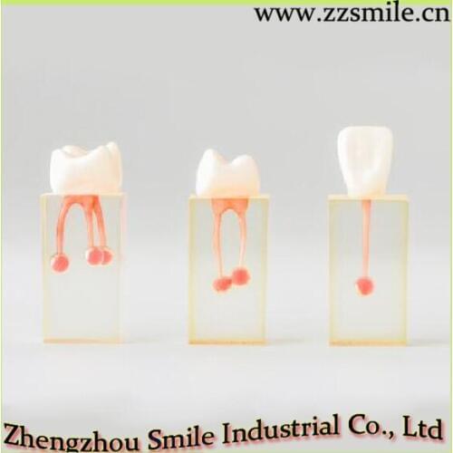 Dental Endo Training Block M8004/Practice Model for Endodontic M8004/1 Set Contains 3 Model