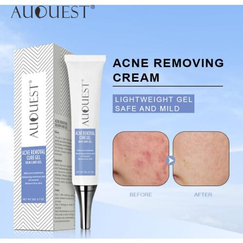 AUQUEST Acne Removal Cream Acne Treatment Oil Control Shrink Pores Whitening Moisturizing Acne Cream Skin Care 20g