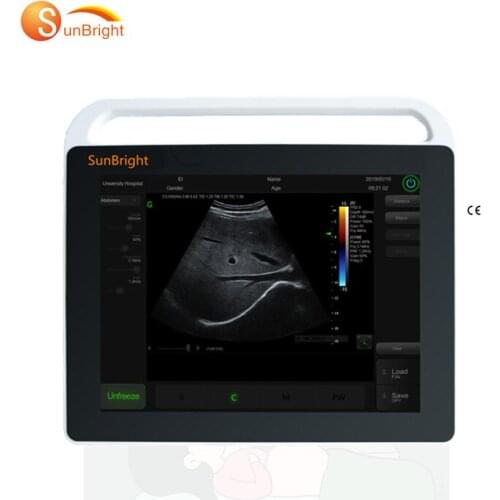 Ultrasound pet ultrasound scanner 15" color display portable medical use for Abdominal scan usg machine price