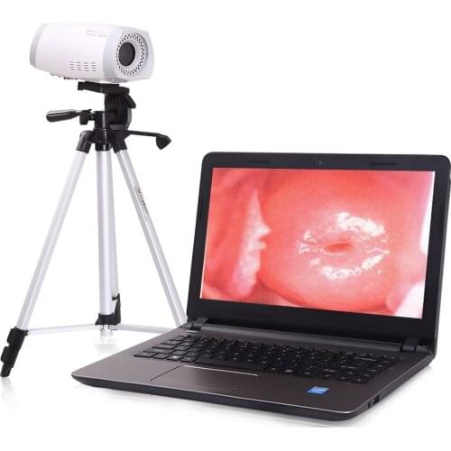 Digital Surgical gynecological colposcopy machine equipment set with camera colposcopy instruments
