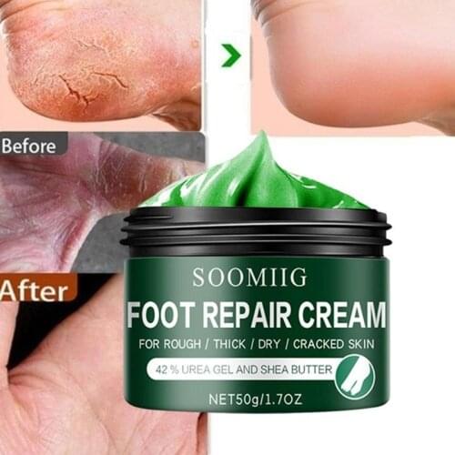 15g/30g/50g Foot Cream Effective Odor Treatment Nourishing Anti-cracking Cream Skin Care Products Exfoliating Repair Cream