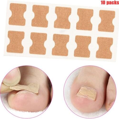2/5Pcs Ingrown Toe Nail Correction Sticker Patch Glue -free Correction Foot Care Treatment
