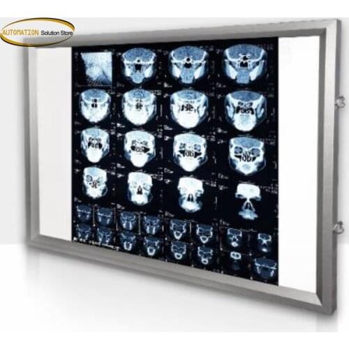 100-240V Hospital X-ray viewing lamp Dental orthopaedic Touch control X-Ray Film Illuminator Light Box X-ray Viewer