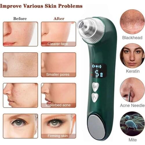 Visual Blackhead Remover Camera LCD Heating Blackhead Remover Pore Vacuum Cleaner Nose Face Deep Cleansing Beauty Device
