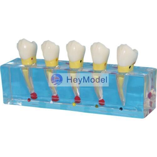 HeyModel Transparent Dental pulp model