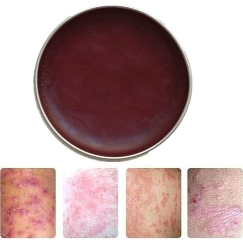 Inner Thigh Whitening Cream, Spotless Inner Thigh, Spots Remover, Fast Action