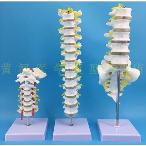1:1 spine model human skeletal model cervical vertebra blood vessel thoracic nerve lumbar disc
