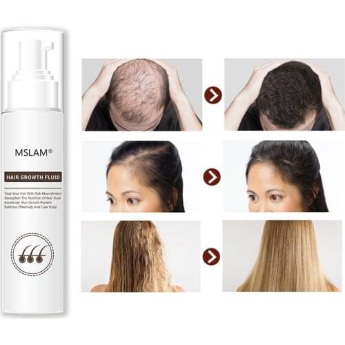 Hair growth nourishing serum Repair growth fluid hair growth products for men oil care of hair care products