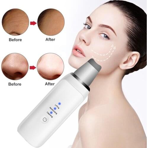Ultrasonic Skin Scrubber Face Spatula Blackhead Remover Pore Cleaner Facial Scrubber Spatula Exfoliator Face Lifting Tool